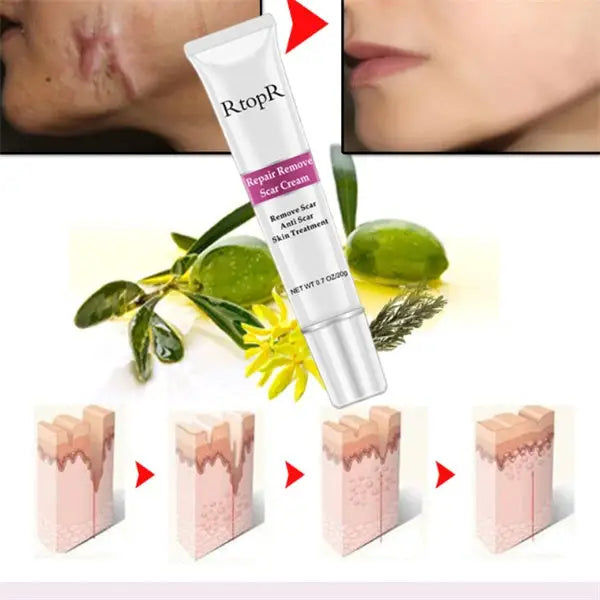 Skin repair cream - White