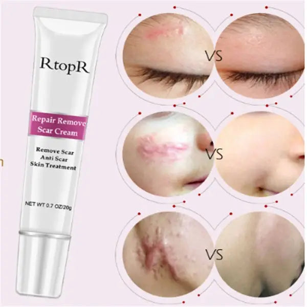 Skin repair cream - White