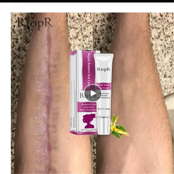 Skin repair cream - White