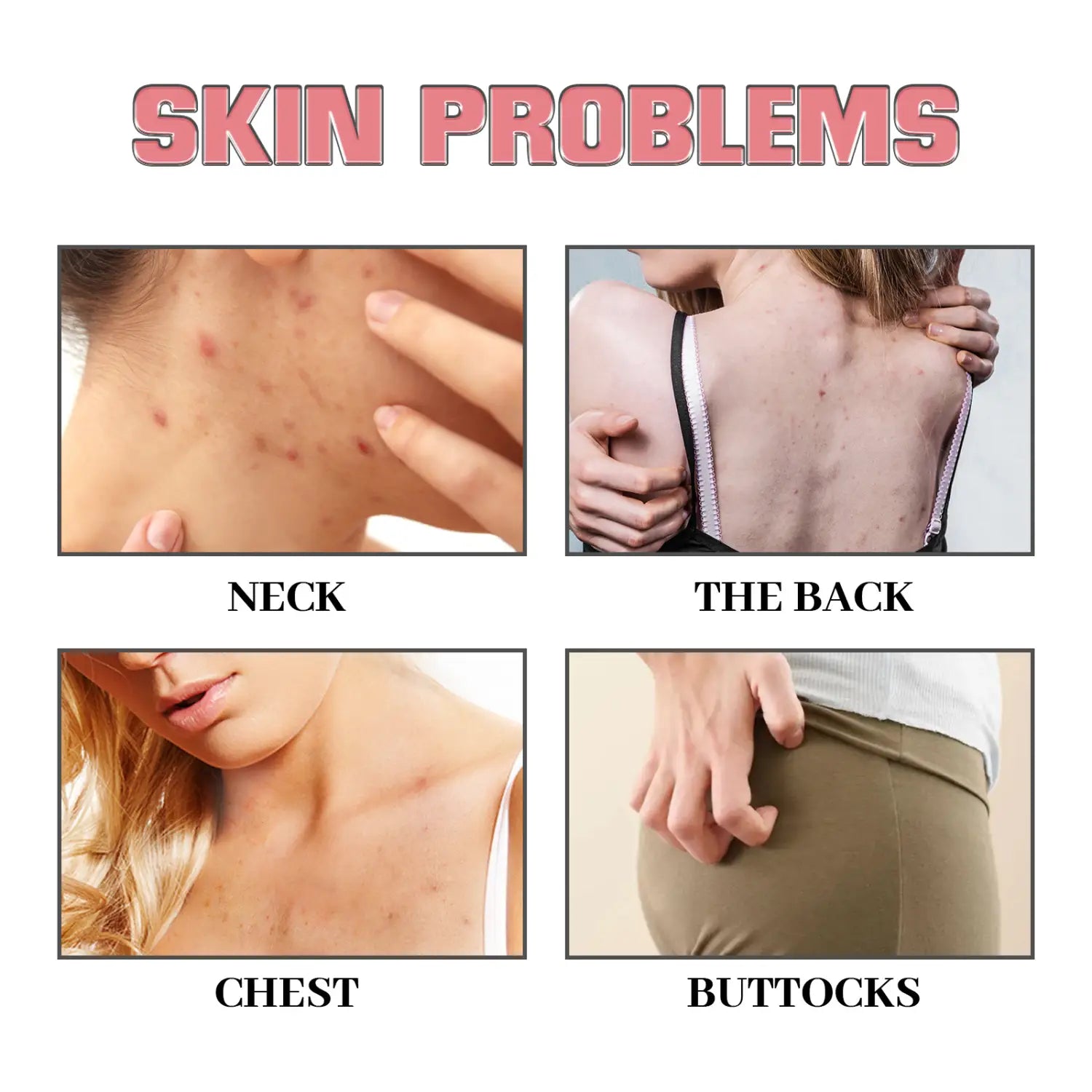 Exfoliating Bath Soap Smallpox Diluting