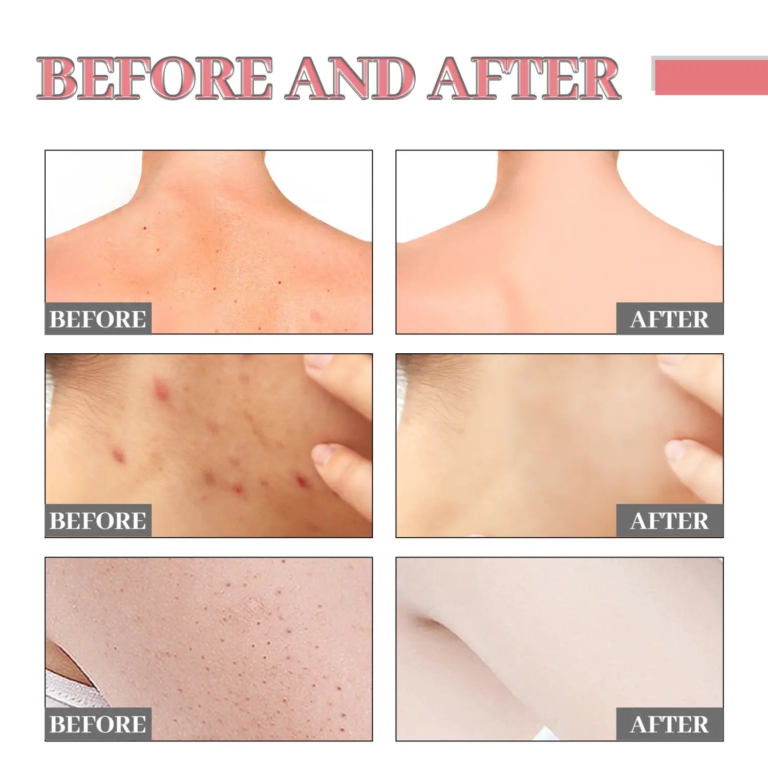 Exfoliating Bath Soap Smallpox Diluting