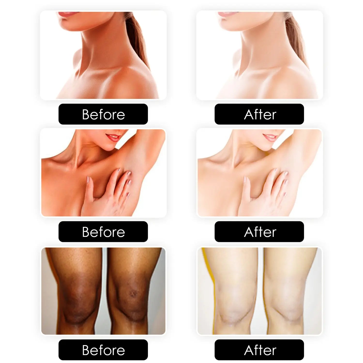 Soap Brightening White Skin Color
