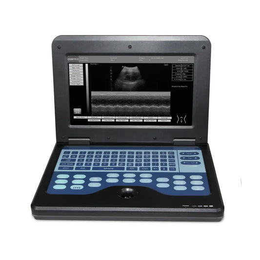 Portable Ultrasound Scanner Laptop Digital Diagnostic Machine 3.5 Convex Probe - CMS600P2