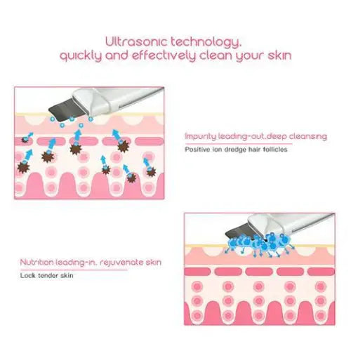 Ultrasonic Skin Scrubber Face Cleanser Blackhead Acne Removal Facial Spa Vibration Massager Ultrasound Peeling Clean Machine 394 Beyond Trends Hub